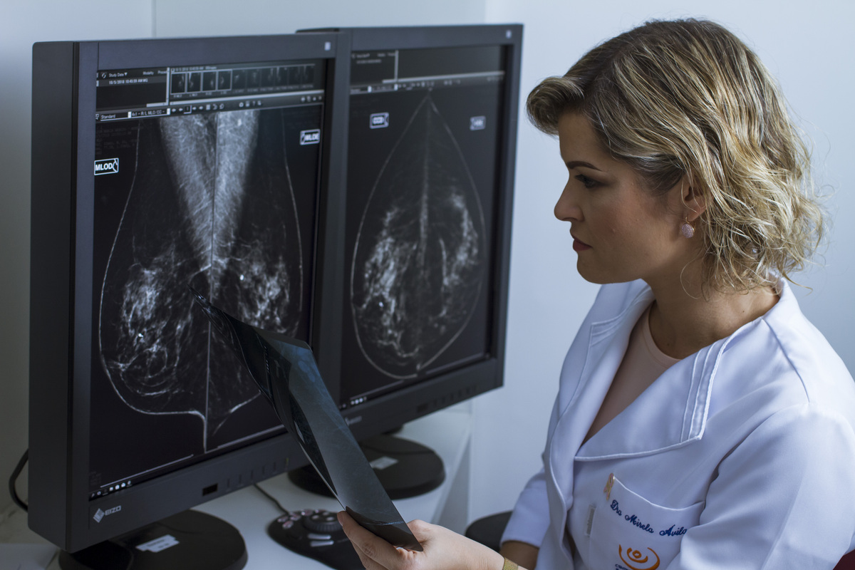 Diagnóstico precoce do câncer de mama: o papel do rastreamento