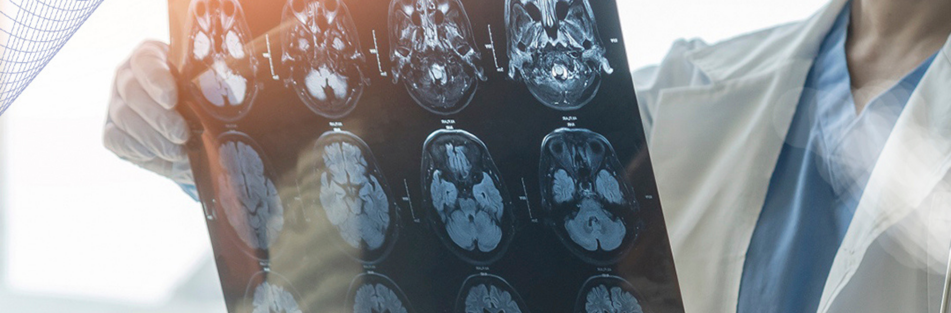 Fique atento: seu cérebro pode estar querendo dizer que algo não anda bem