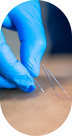 MARCAÇÃO PRÉ-CIRÚRGICA